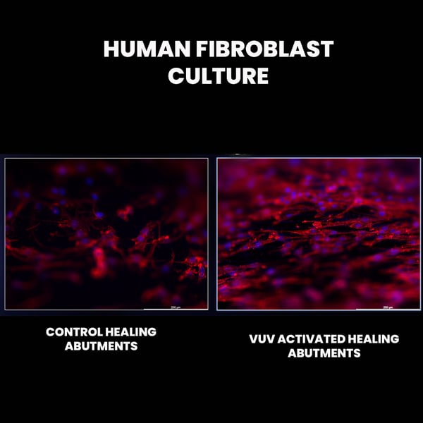human fibroblast